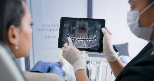Licensed Dental Implants service in Summit, NJ - Smile Center Dentistry